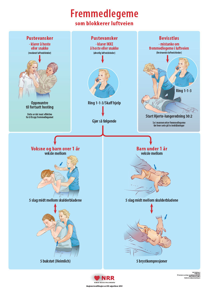 Fremmedlegeme Veggplakat Gjenoppliving No